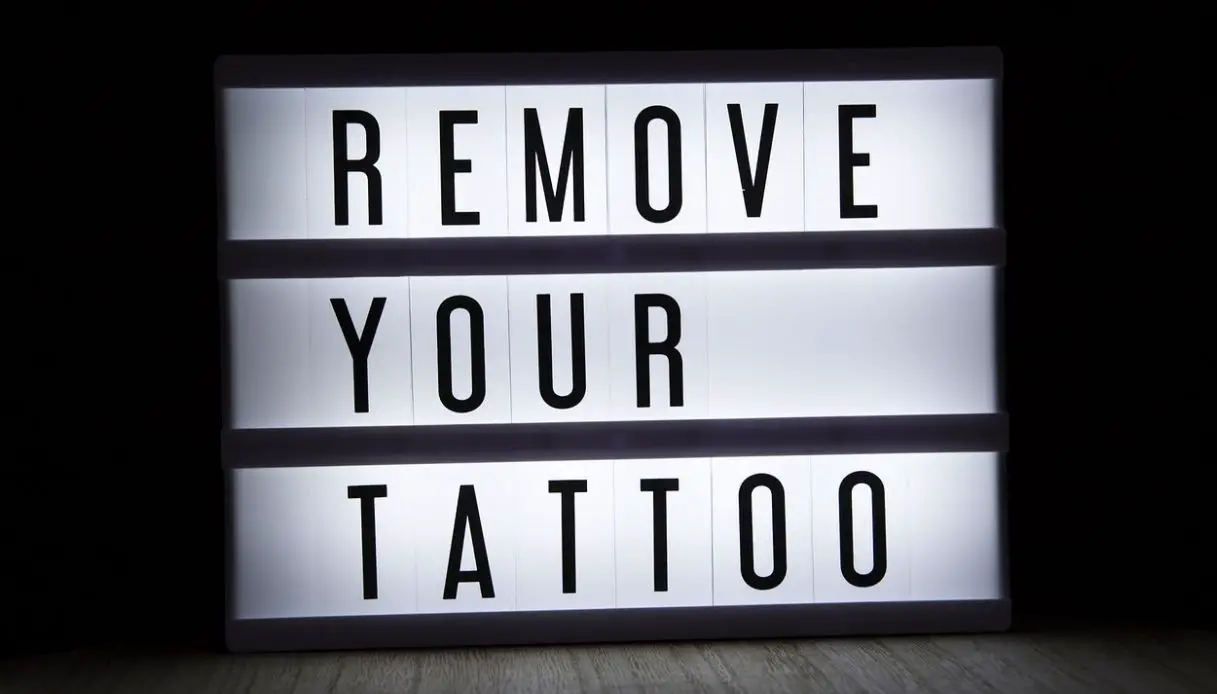 cartello con scritta sulla rimozione tatuaggio